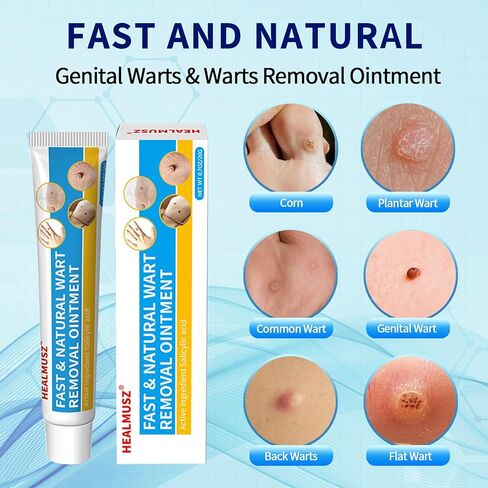 يحتوي مزيل الثآليل من هيلموس على 17% من حمض الساليسيليك لإزالة الطغوات الجلدية وكريم إزالة الثآليل الطبيعي سريع المفعول للثآليل الشائعة والثآليل الأخمصية والثآليل الأخرى في الجسم in Kuwait