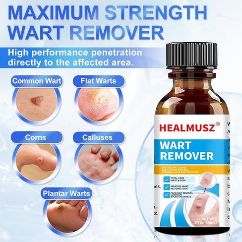 سائل مزيل الثآليل من HEALMUSZ 5% من حمض الساليسيليك يتجمد الثآليل، مزيل الثآليل يتجمد للأعضاء التناسلية، H Wart، شائع، مسطح، الذرة، مسامير القدم، مزيل الثآليل الأخمصية على القدمين، H in Kuwait