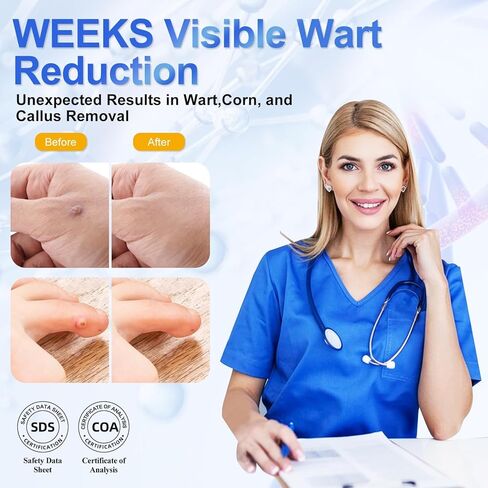 سائل مزيل الثآليل من HEALMUSZ 5% من حمض الساليسيليك يتجمد الثآليل، مزيل الثآليل يتجمد للأعضاء التناسلية، H Wart، شائع، مسطح، الذرة، مسامير القدم، مزيل الثآليل الأخمصية على القدمين، H in Kuwait