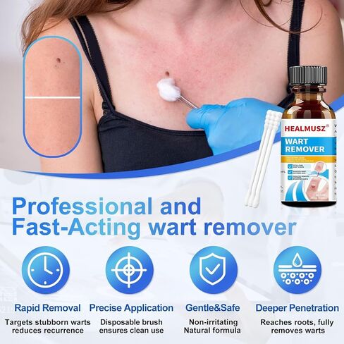 سائل مزيل الثآليل من HEALMUSZ 5% من حمض الساليسيليك يتجمد الثآليل، مزيل الثآليل يتجمد للأعضاء التناسلية، H Wart، شائع، مسطح، الذرة، مسامير القدم، مزيل الثآليل الأخمصية على القدمين، H in Kuwait