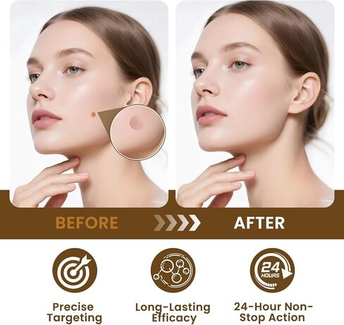 رقعات مزيلة لثآليل سم النحل ذات القوة القصوى - سريعة المفعول وغير مؤلمة وقابلة للحمل | مثالي للبشرة الحساسة والمستخدمين الذين يعانون من الألم ولجميع ألوان البشرة | 144 عدد in Kuwait