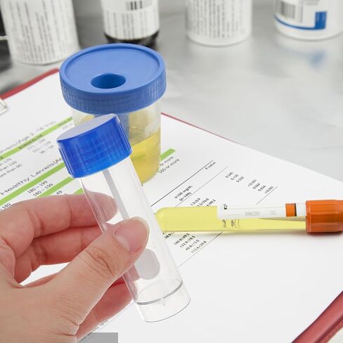 طقم حاوية عينات البراز، 10 قطع كوب عينات سعة 25-30 مل مع ملعقة بأغطية، حاوية بلاستيكية لجمع البراز، أكواب بول للاستخدام الطبي المختبري in Kuwait