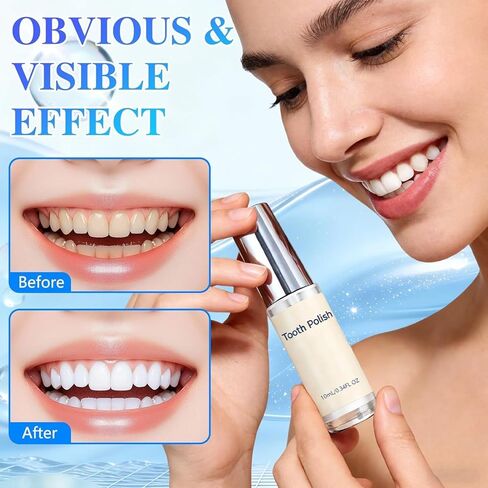 طلاء الأسنان وتبييض الأسنان - قطعتان من طلاء الأسنان الأبيض الطبيعي، تركيبة لطيفة وآمنة، طلاء أبيض بسيط ومحمول للأسنان لاستعادة الابتسامة الواثقة (إجمالي 20 مل) in Kuwait