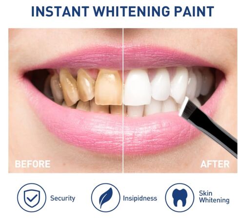 طلاء الأسنان - طلاء فعال لتبييض الأسنان، محمول ومريح، لطيف على الأسنان الحساسة، عبوتان in Kuwait