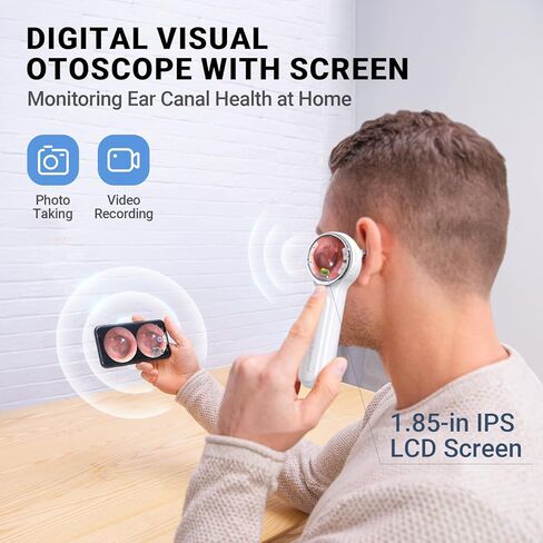 ScopeAround Otoscope, 720PHD Ear Scope Set, Digital Otoscope w/1.85in IPS Screen, Ear Wax Removal Tool Camera, Video Otoscope Ear Camera with 6 LED Lights, Compatible with Android/iPhone in Kuwait