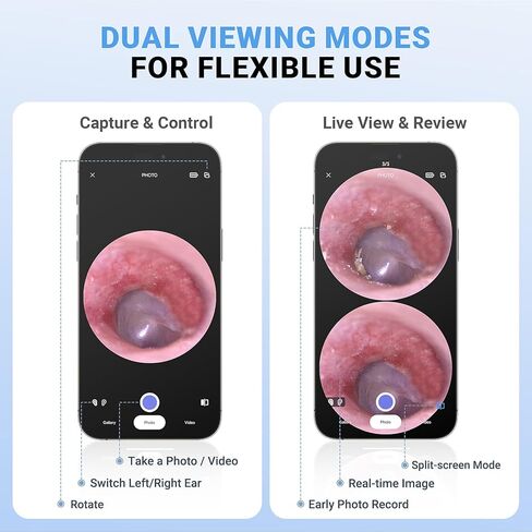 ScopeAround Otoscope, 720PHD Ear Scope Set, Digital Otoscope w/1.85in IPS Screen, Ear Wax Removal Tool Camera, Video Otoscope Ear Camera with 6 LED Lights, Compatible with Android/iPhone in Kuwait