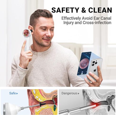 ScopeAround Otoscope, 720PHD Ear Scope Set, Digital Otoscope w/1.85in IPS Screen, Ear Wax Removal Tool Camera, Video Otoscope Ear Camera with 6 LED Lights, Compatible with Android/iPhone in Kuwait