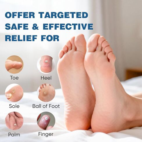 240 قطعة من وسائد مسامير القدم من KINDSHINE، مزيلات الذرة لأصابع القدم، وسادات ذرة لاصقة ذاتية اللصق، تحمي من مسامير القدم والذرة والبثور من الضغط والاحتكاك (بيج، مقاس صغير لإصبع القدم) in Kuwait