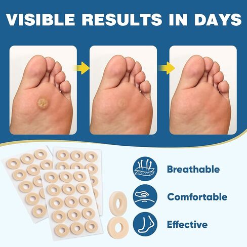 240 قطعة من وسائد مسامير القدم من KINDSHINE، مزيلات الذرة لأصابع القدم، وسادات ذرة لاصقة ذاتية اللصق، تحمي من مسامير القدم والذرة والبثور من الضغط والاحتكاك (بيج، مقاس صغير لإصبع القدم) in Kuwait