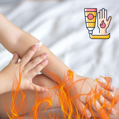 كريم الإسعافات الأولية للحروق، مطهر لتخفيف الحروق، 144 لكل صندوق توزيع 0.9 جرام MS60768 in Kuwait