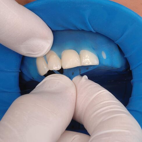 تشكيلة السدود المطاطية Vivadent 627401 Ivoclar OptraDam Plus 50/Bx in Saudi Arabia