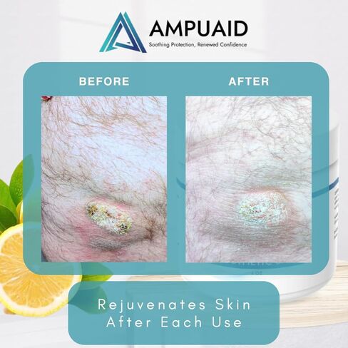 Soothing Prosthetic Salve [New Formula] – High-Viscosity Barrier with Lanolin USP & Organic Beeswax, 4 oz in Kuwait