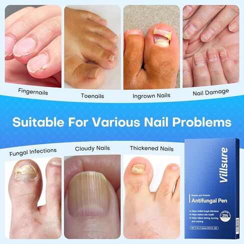 قلم فطريات أظافر القدم من فيلشور - علاج فطريات أظافر القدم بقوة إضافية، يحتوي على 25% من حمض الأنديسينويك وزيوت شجرة الشاي، بالإضافة إلى مكونات طبيعية أخرى، خفيف وغير مهيج - قلم فطريات الأظافر 5 قطع in Kuwait