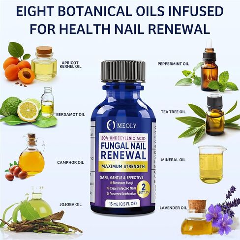 تجديد الأظافر الفطرية: 30% حمض الأنديسيلينيك، علاج قوي لفطريات أظافر القدم بالزيوت الطبيعية - ضمادة أظافر، مبرد أظافر وفرشاة للأظافر الغارزة في الجلد وتغير اللون، 30 مل in Kuwait