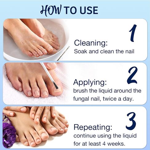 تجديد الأظافر الفطرية: 30% حمض الأنديسيلينيك، علاج قوي لفطريات أظافر القدم بالزيوت الطبيعية - ضمادة أظافر، مبرد أظافر وفرشاة للأظافر الغارزة في الجلد وتغير اللون، 30 مل in Kuwait