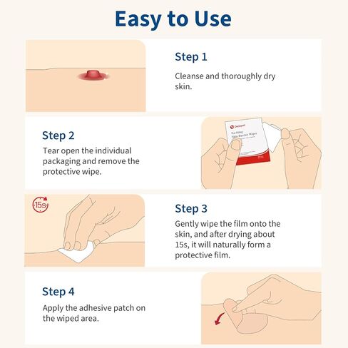 100 Pcs Skin Barrier Wipes, 2.4" x 3.5" Skin Prep Protective Wipes, No Sting Skin Adhesive Wipes to Create The Barrier Film Between Skin and Attachments, Ostomy Barrier Film Wipes (Alcohol Free) in Kuwait