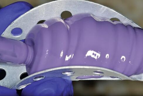 50/Pcs Dental Dental Temporary Impression Trays for Crown and Bridge Disposable Temporary Tray Premium Aluminum Pack in Kuwait