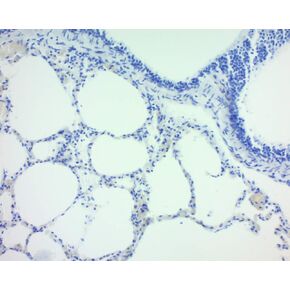 هيماتوكسيلين، ماير (تعديل ليلي)، 1000 مل in Kuwait