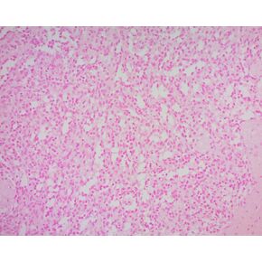 محلول أحمر سريع نووي، 1000 مل in Kuwait