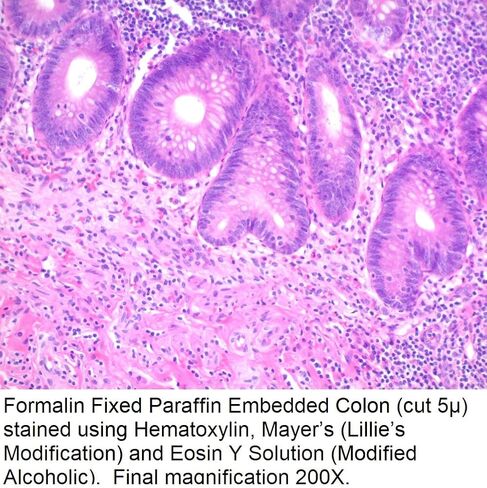 هيماتوكسيلين، ماير (تعديل ليلي)، 1000 مل in Kuwait