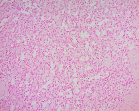 محلول أحمر سريع نووي، 1000 مل in Kuwait