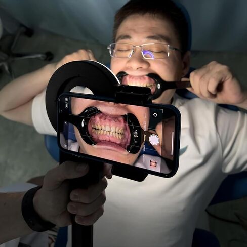 Dentistry LED Oral Filling Light, Oral Cell Phone Camera Fill Light with 49mm Filter and 100mm Macro Lens, 3-Color Lighting & Color Temperature 2500K- 6000K, Dental Photography Aid for Home Salon in Kuwait