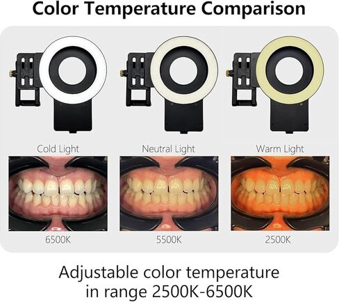 Dentistry LED Oral Filling Light, Oral Cell Phone Camera Fill Light with 49mm Filter and 100mm Macro Lens, 3-Color Lighting & Color Temperature 2500K- 6000K, Dental Photography Aid for Home Salon in Kuwait