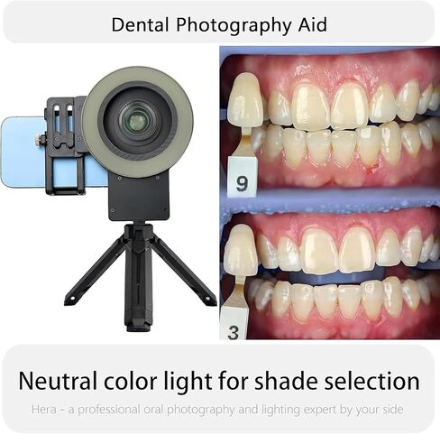 Dentistry LED Oral Filling Light, Oral Cell Phone Camera Fill Light with 49mm Filter and 100mm Macro Lens, 3-Color Lighting & Color Temperature 2500K- 6000K, Dental Photography Aid for Home Salon in Kuwait