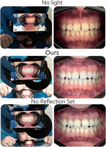 Dentistry LED Oral Filling Light, Oral Cell Phone Camera Fill Light with 49mm Filter and 100mm Macro Lens, 3-Color Lighting & Color Temperature 2500K- 6000K, Dental Photography Aid for Home Salon in Kuwait