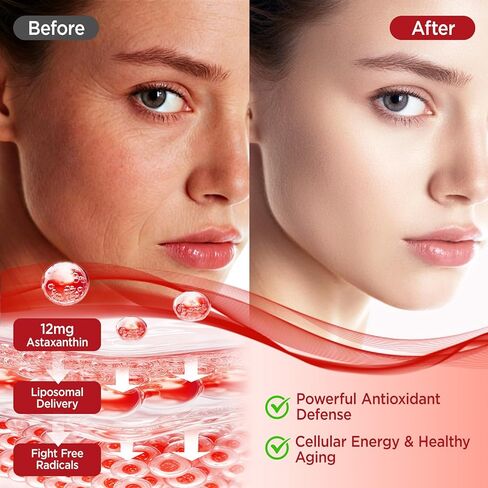 Liposomal Astaxanthin Gummies, Organic Astaxanthin 12mg Supplements with Lycopene, Glutathione for Powerful Antioxidant, Plus Vitamins & CoQ10 for Eye, Skin & Immune Health, Sugar Free, Vegan, 60 in Kuwait