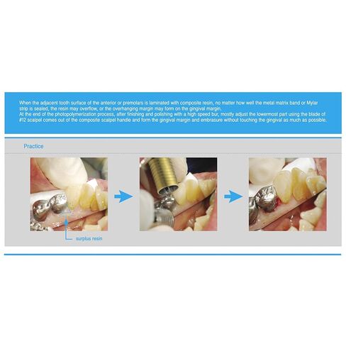Osung Composite Scalpel Handle Adjustable Premium -SHCS2 in Saudi Arabia