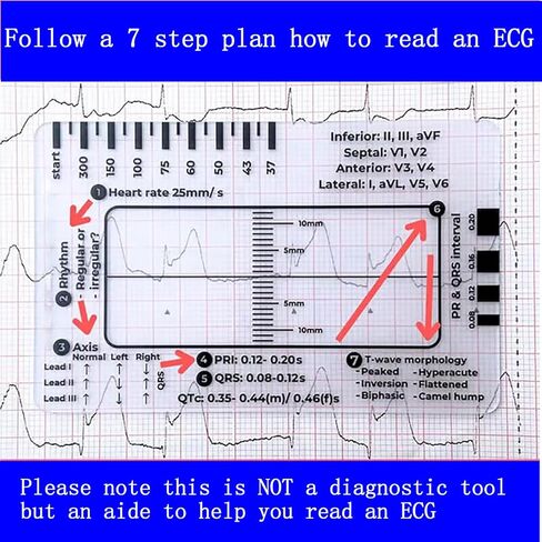 3 قطع مسطرة تخطيط القلب ذات 7 خطوات، مسطرة تخطيط القلب ذات 7 خطوات لتفسير تخطيط القلب/رسم القلب، أداة قياس بلاستيكية مسطرة تخطيط القلب، أداة قياس فرجار رسم القلب الشفاف، اتبع خطة من 7 خطوات، أداة محمولة بطاقة رسم القلب in Kuwait