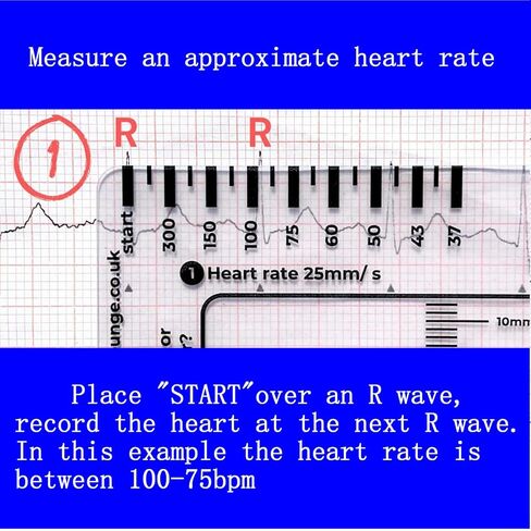 3 قطع مسطرة تخطيط القلب ذات 7 خطوات، مسطرة تخطيط القلب ذات 7 خطوات لتفسير تخطيط القلب/رسم القلب، أداة قياس بلاستيكية مسطرة تخطيط القلب، أداة قياس فرجار رسم القلب الشفاف، اتبع خطة من 7 خطوات، أداة محمولة بطاقة رسم القلب in Kuwait