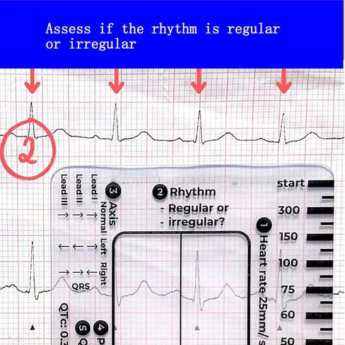 3 قطع مسطرة تخطيط القلب ذات 7 خطوات، مسطرة تخطيط القلب ذات 7 خطوات لتفسير تخطيط القلب/رسم القلب، أداة قياس بلاستيكية مسطرة تخطيط القلب، أداة قياس فرجار رسم القلب الشفاف، اتبع خطة من 7 خطوات، أداة محمولة بطاقة رسم القلب in Kuwait