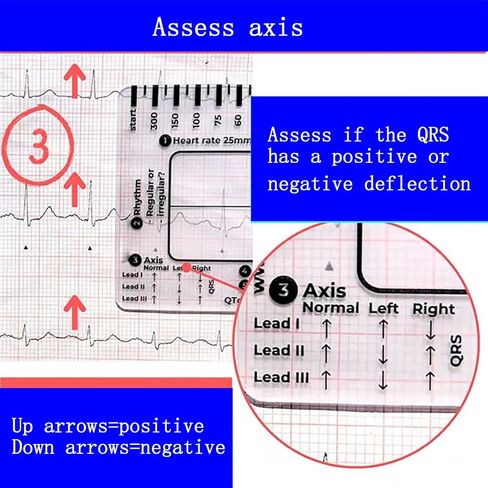 3 قطع مسطرة تخطيط القلب ذات 7 خطوات، مسطرة تخطيط القلب ذات 7 خطوات لتفسير تخطيط القلب/رسم القلب، أداة قياس بلاستيكية مسطرة تخطيط القلب، أداة قياس فرجار رسم القلب الشفاف، اتبع خطة من 7 خطوات، أداة محمولة بطاقة رسم القلب in Kuwait