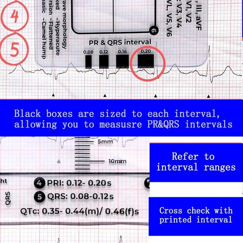 3 قطع مسطرة تخطيط القلب ذات 7 خطوات، مسطرة تخطيط القلب ذات 7 خطوات لتفسير تخطيط القلب/رسم القلب، أداة قياس بلاستيكية مسطرة تخطيط القلب، أداة قياس فرجار رسم القلب الشفاف، اتبع خطة من 7 خطوات، أداة محمولة بطاقة رسم القلب in Kuwait