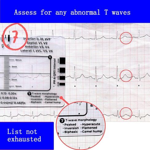 3 قطع مسطرة تخطيط القلب ذات 7 خطوات، مسطرة تخطيط القلب ذات 7 خطوات لتفسير تخطيط القلب/رسم القلب، أداة قياس بلاستيكية مسطرة تخطيط القلب، أداة قياس فرجار رسم القلب الشفاف، اتبع خطة من 7 خطوات، أداة محمولة بطاقة رسم القلب in Kuwait