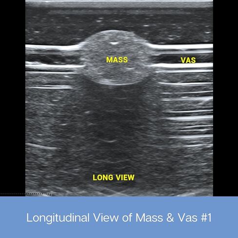 وسادة ممارسة الموجات فوق الصوتية؛ نموذج تدريب بالموجات فوق الصوتية لممارسة إدخال الإبرة - وسادة محاكاة الأوعية الدموية والأعصاب للتعليم الطبي (وسادة الأوعية الدموية والكتلة) in Kuwait