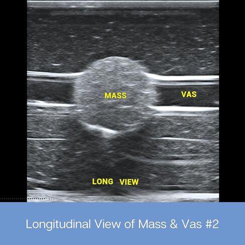وسادة ممارسة الموجات فوق الصوتية؛ نموذج تدريب بالموجات فوق الصوتية لممارسة إدخال الإبرة - وسادة محاكاة الأوعية الدموية والأعصاب للتعليم الطبي (وسادة الأوعية الدموية والكتلة) in Kuwait