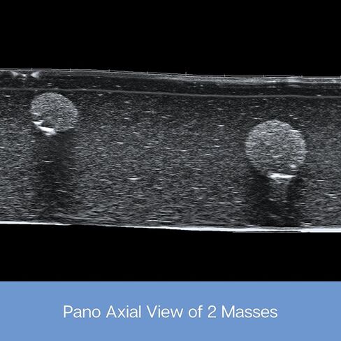 وسادة ممارسة الموجات فوق الصوتية؛ نموذج تدريب بالموجات فوق الصوتية لممارسة إدخال الإبرة - وسادة محاكاة الأوعية الدموية والأعصاب للتعليم الطبي (وسادة الأوعية الدموية والكتلة) in Kuwait