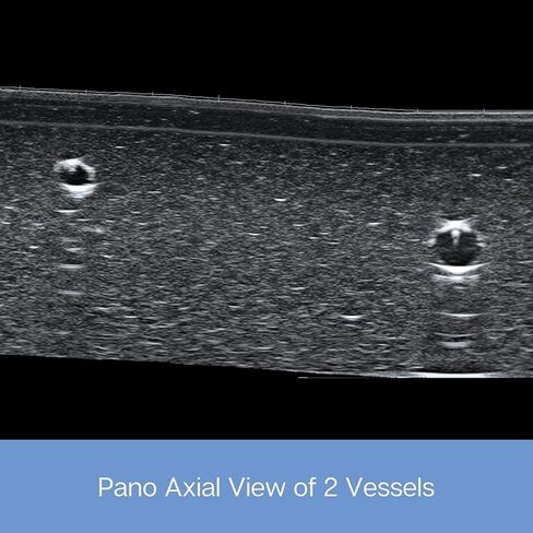 وسادة ممارسة الموجات فوق الصوتية؛ نموذج تدريب بالموجات فوق الصوتية لممارسة إدخال الإبرة - وسادة محاكاة الأوعية الدموية والأعصاب للتعليم الطبي (وسادة الأوعية الدموية والكتلة) in Kuwait