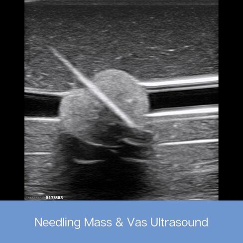 وسادة ممارسة الموجات فوق الصوتية؛ نموذج تدريب بالموجات فوق الصوتية لممارسة إدخال الإبرة - وسادة محاكاة الأوعية الدموية والأعصاب للتعليم الطبي (وسادة الأوعية الدموية والكتلة) in Kuwait