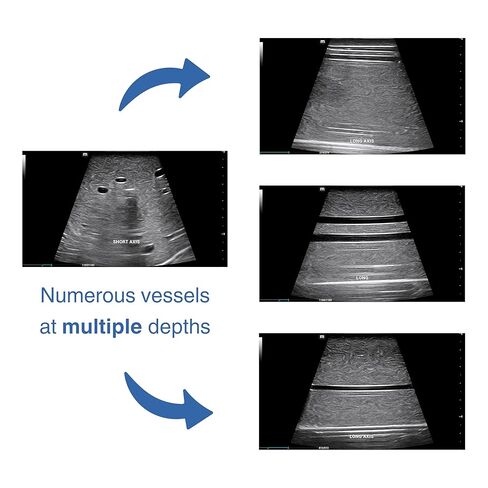 فانتوم الوصول إلى الأوعية الدموية بالموجات فوق الصوتية - نموذج الذراع للتدريب على الوريد والقسطرة in Kuwait