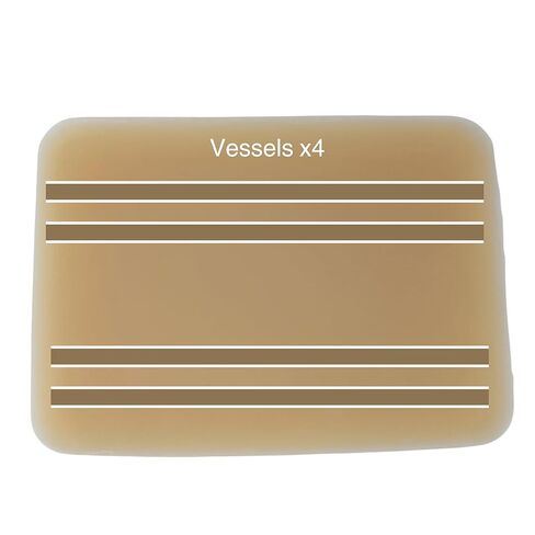 وسادة ممارسة الموجات فوق الصوتية؛ نموذج التدريب بالموجات فوق الصوتية لممارسة إدخال الإبرة . وسادة محاكاة الأوعية الدموية للتعليم الطبي in Kuwait