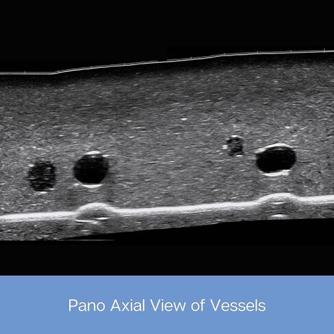 وسادة ممارسة الموجات فوق الصوتية؛ نموذج التدريب بالموجات فوق الصوتية لممارسة إدخال الإبرة . وسادة محاكاة الأوعية الدموية للتعليم الطبي in Kuwait