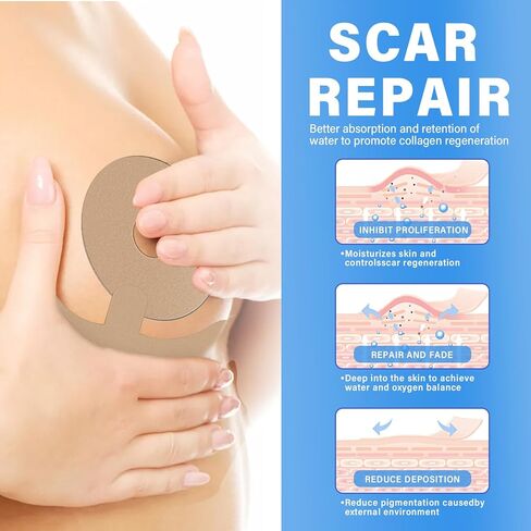 Silicone Scar Sheets - Medical Grade Silicone Scar Sheets for Breast - 4 Pair Reusable & Breathable Strips, Soft Post-Surgery Tape for Scar Prevention in Kuwait