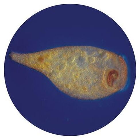 Stentor coeruleus, Living in Kuwait