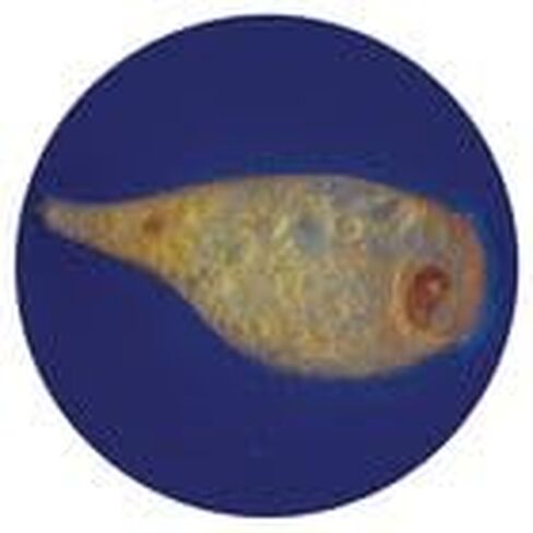 Stentor coeruleus, Living in Kuwait