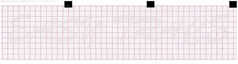 ورق تخطيط القلب Z-FOLD 60 مم × 75 مم × 250 ورقة (يعمل مع 66010040، CARDIETTE AR600، CARDIORAPID K130-D) (10) in Kuwait