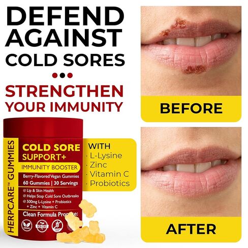 علاج قروح البرد لدعم الشفاه والبشرة باستخدام إل-ليسين والزنك وفيتامين ج والبروبيوتيك | معزز نباتي للمناعة يساعد على منع تفشي المرض ويعزز الشفاء بشكل أسرع | 60 علكة بنكهة التوت in Kuwait